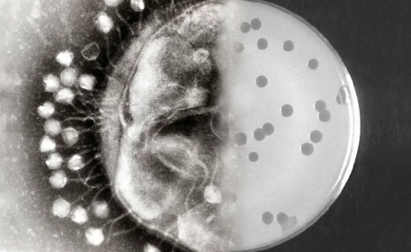 What Are Bacteriophages And How Do They Make Food Safer?