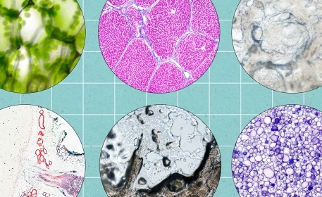 Bioavailability of Plant-Based Proteins