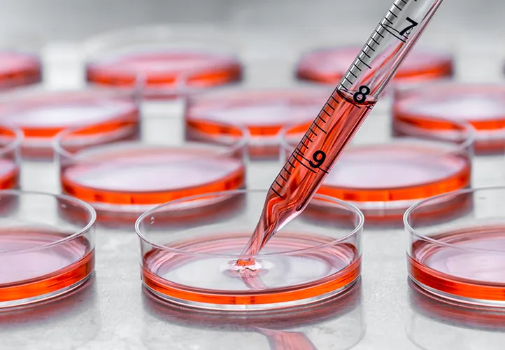 lab tests