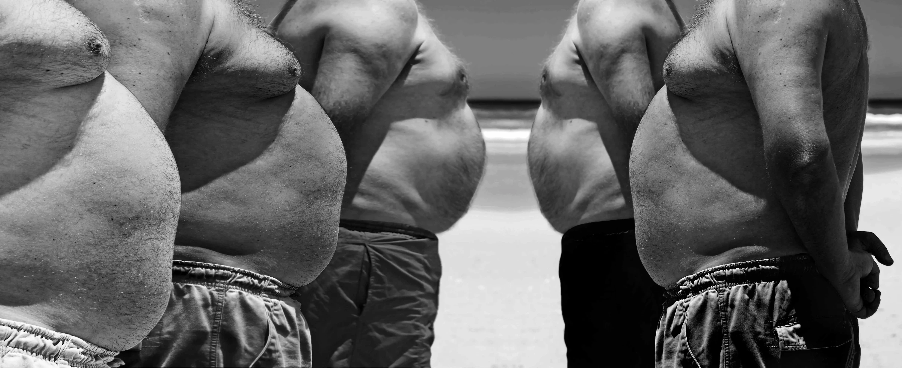 Obesity people